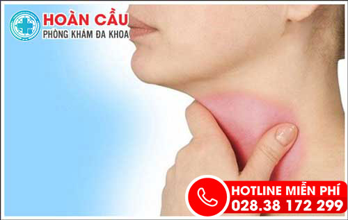 Biến chứng nguy hiểm của bệnh viêm họng mạn tính