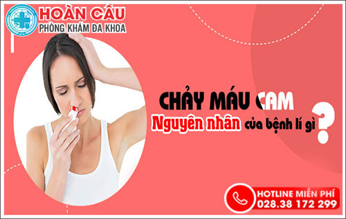 Chảy máu cam - dấu hiệu của nhiều bệnh lý nguy hiểm chớ coi thường