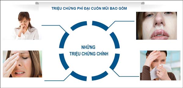 Dấu hiệu nhận biết bệnh phì đại cuốn mũi