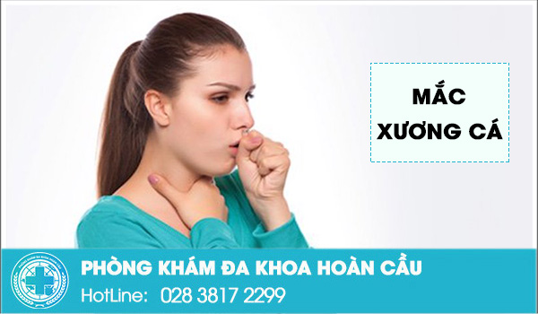 Mắc xương cá – chuyện nhỏ nhưng hậu quả lớn