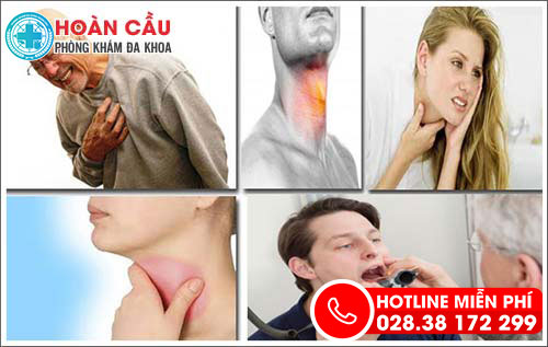 Viêm họng xung huyết: Triệu chứng và cách chữa trị hiệu quả